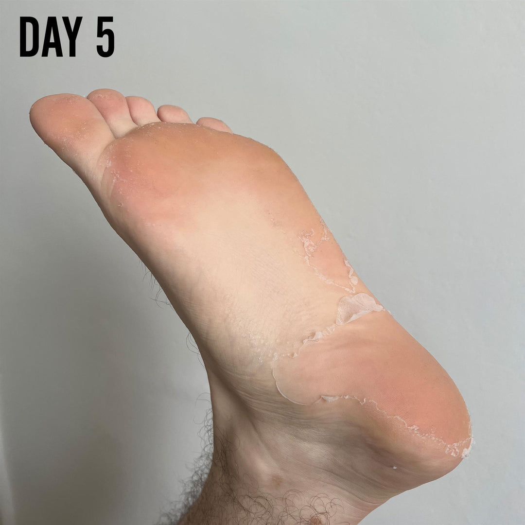 Barber Pro Foot Peel Mask