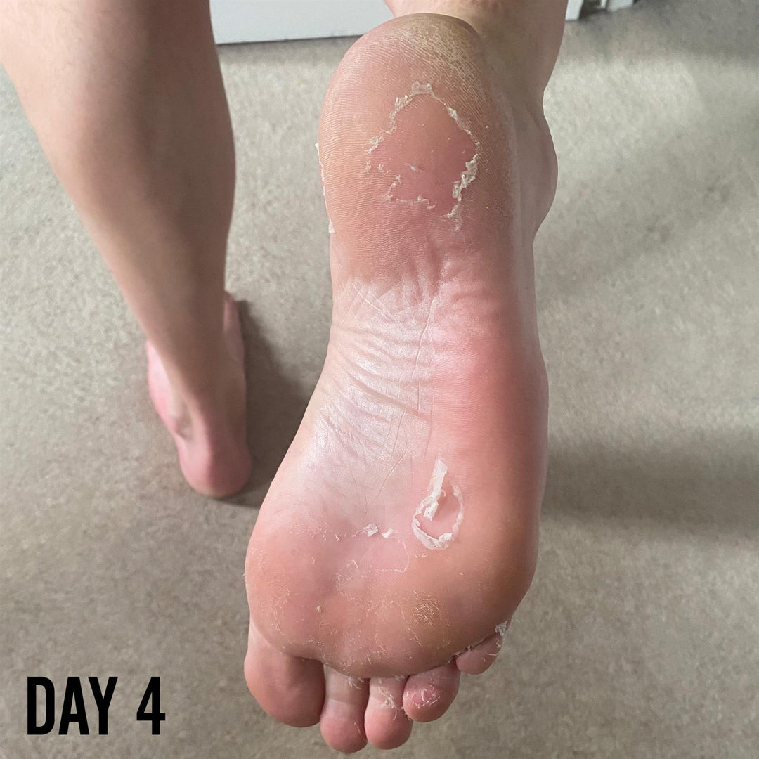 Barber Pro Foot Peel Mask